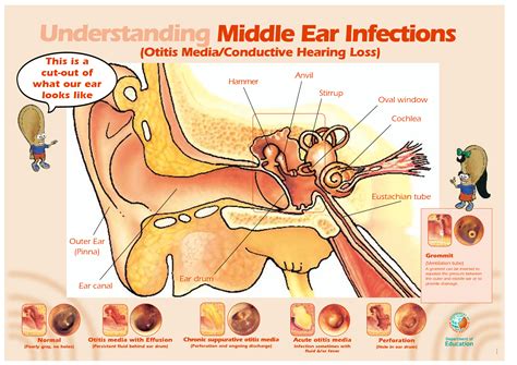 What Does An Infected Ear Drum Look Like at Debra Schaper blog