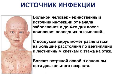 Ветрянка | lemur59.ru