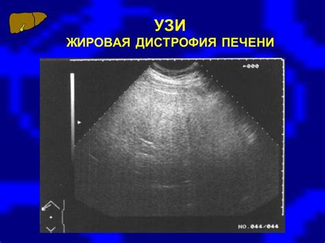 Размеры печени на УЗИ: норма у взрослых мужчин и женщин, какие должны ...