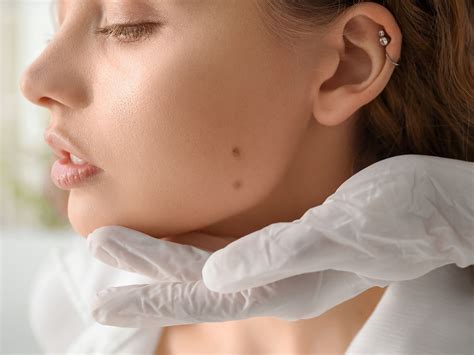 Precision Skin Surgery - Vitality Derm Surg