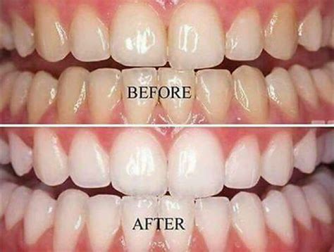 product reviews tips whitening toothpaste  works