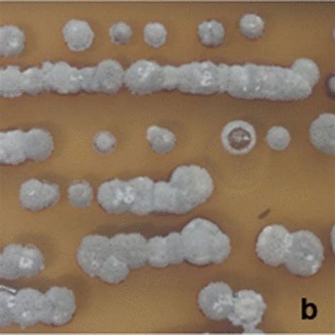 Morphological characteristics of Streptomyces sp. isolates. a spore ...