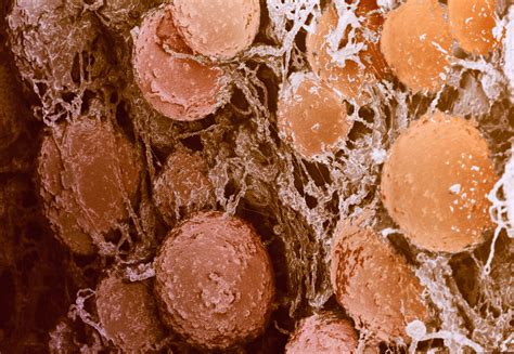 fat cell types   key  obesity pursuit