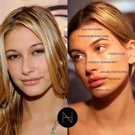 Before and After: The Hottest Women Celebrity's Transformation - icd9kns
