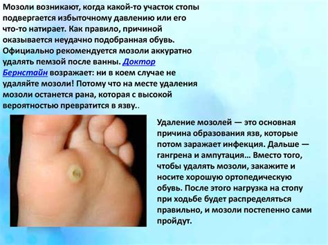 Диабетическая стопа - презентация онлайн