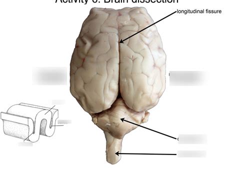 Brain dissection Diagram | Quizlet