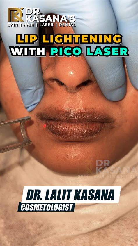 laser lip plumping      artofit