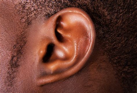 Why Is My Ear Canal Swollen? Causes & Solutions | Amplifon USA