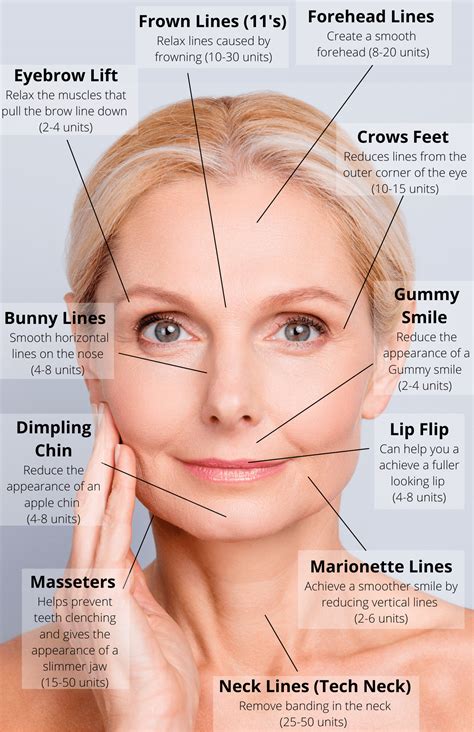 Botox Injections in Salt Lake City | Botulinum Toxin | Botox injections ...