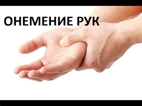 Онемение рук и пальцев верхней конечности. - YouTube