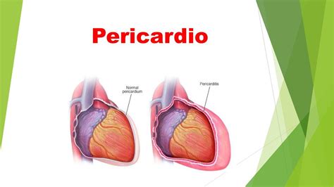 Pericardio Fibroso E Seroso - Pericardio | Pericardio | Medicina | uDocz
