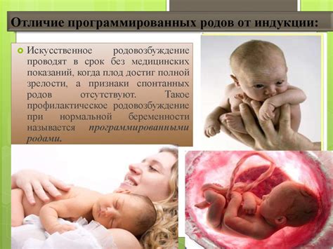 Индукция родов (родовозбуждение) - презентация онлайн