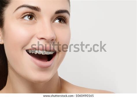 Girl Braces Smile: Over 34,882 Royalty-Free Licensable Stock Photos ...
