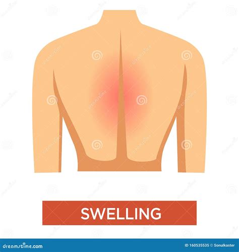 Swelling in Back Symptom of Arthritis in Person Stock Vector