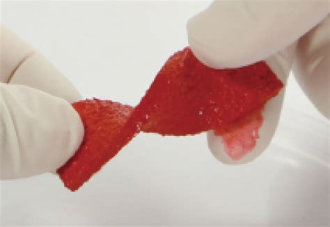 COLLAGEN - MBI | Medical Device Manufacturer of Hyaluronic Acid ...
