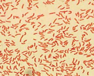 Helicobacter pylori - Microbiology Specialists Inc.