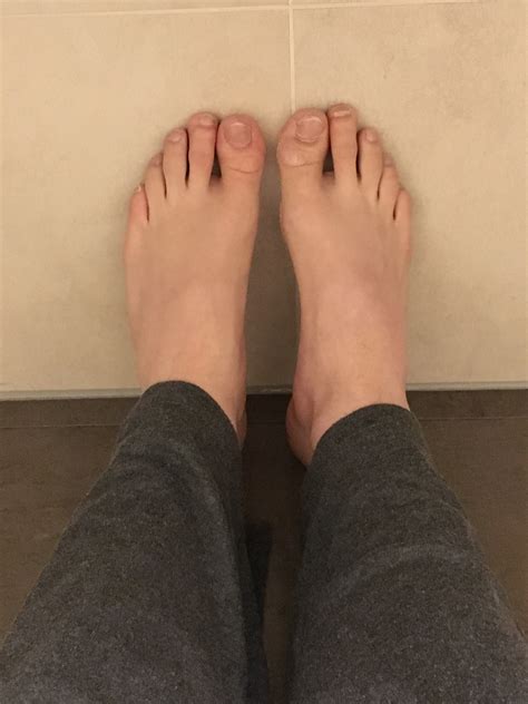 Mangelndes Selbstbewusstsein wenn barfuß, was tun? (Gesundheit, Füße)