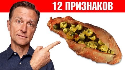 12 симптомов того, что желчный пузырь в опасности!😲 - YouTube