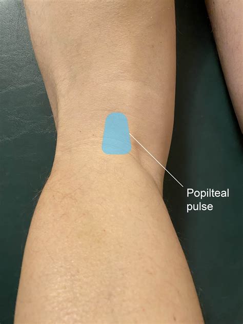 popliteal pulse landmark anterior tibial artery anatomy
