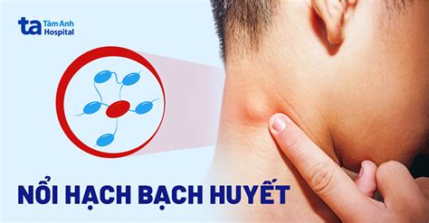 sung noi hach bach huyet nguyen nhan dau hieu va cach dieu tri