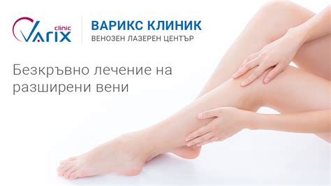 Варикс Клиник - Лечение на разширени вени