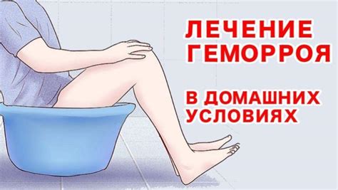 Геморрой у женщин: что это такое, причины, симптомы и признаки ...