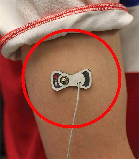 level  health monitoring  interstitial fluid replace