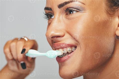 CleaningTeeth With Braces 13705939 Stock Photo at Vecteezy