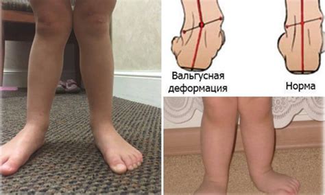 Публикации специалистов нейропсихологического центра Достижение в Пензе
