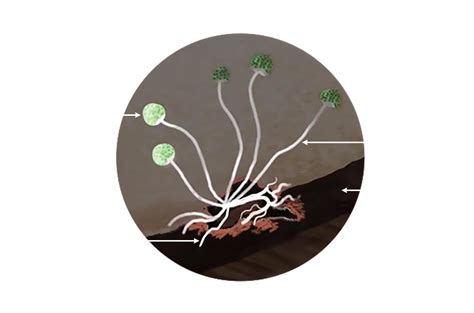 Describe reproduction by spores in Rhizopus.