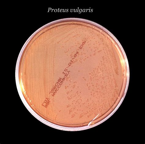 Proteus (bakterioa) - Wikipedia, entziklopedia askea.