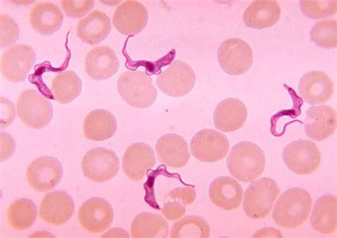 O Que É Trypanosoma Cruzi - Trypanosoma cruzi: ciclo de vida, morfologia, características