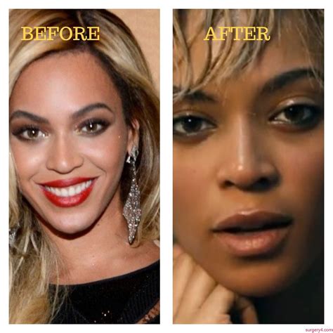 Beyonce Nose Job Before After