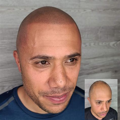 What are Hair Tattoos? — Got Scalp