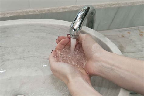 how to get rid of whiteheads 1