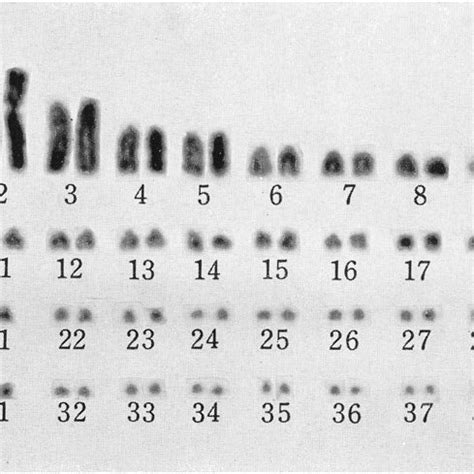 -Karyotype of a cell shown m Fig. 1. | Download Scientific Diagram