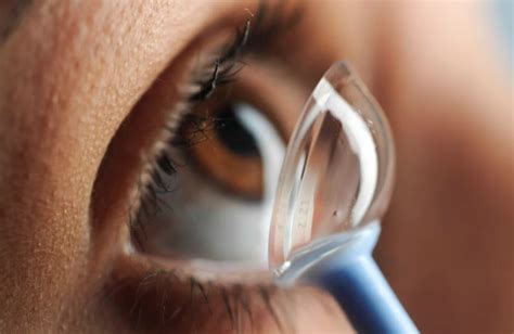 Keratoconus Contact Lenses - Village Eyecare