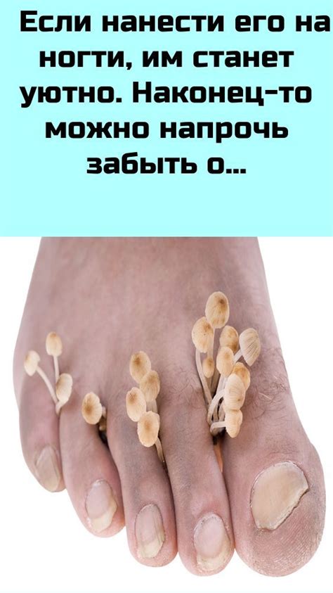 Если нанести его на ногти, им станет уютно. Наконец-то можно напрочь ...