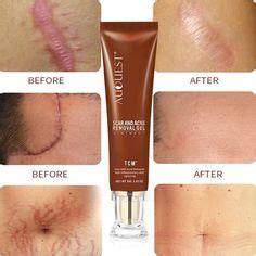 Pin by *ﾟ . 𝓔𝓵𝓲𝓯 . *ﾟ on Sizin Pinleriniz in 2024 | Skin care routine ...
