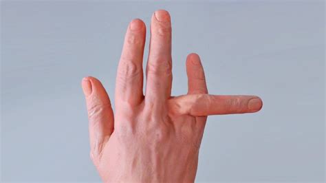 how long does dislocated finger take to heal
