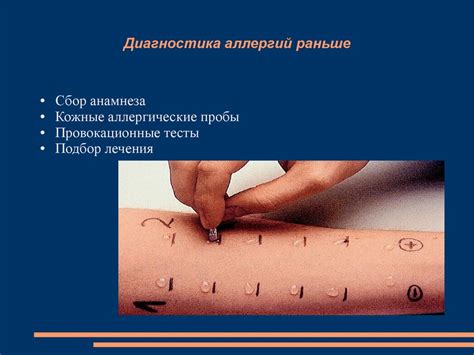 Моллекулярная аллергодиагностика - презентация онлайн