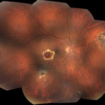 discover images retina image bank