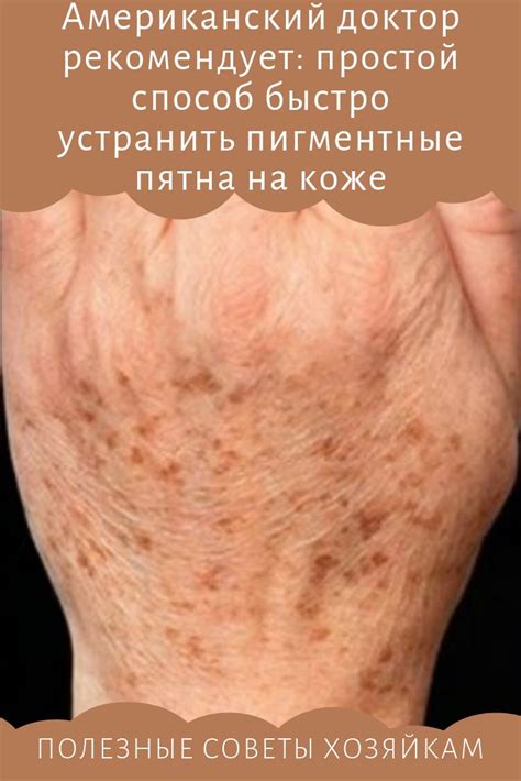 Американский доктор рекомендует: простой способ быстро устранить ...