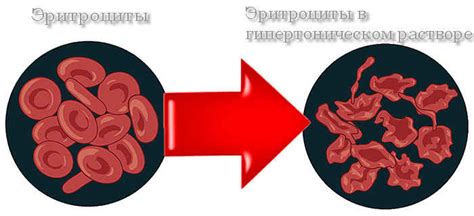 Что делают эритроциты, помещенные в гипертонический раствор?