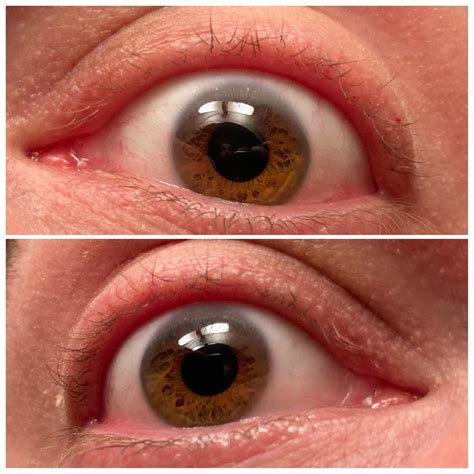 can men cut their eyelashes 7