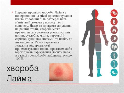 Презентація на тему : Обережно кліщі!