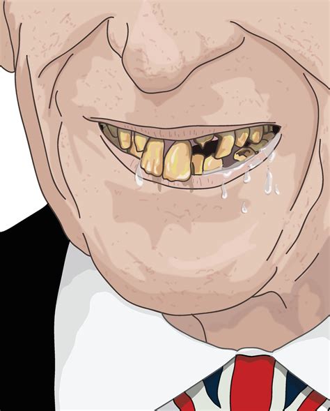 Why Did Archies Teeth Fall Out 2