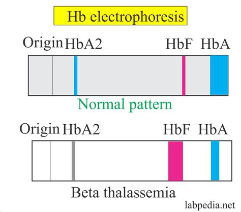 Fetal Hemoglobin (HbF, Alkali resistant Hemoglobin, Fetal HbF ...