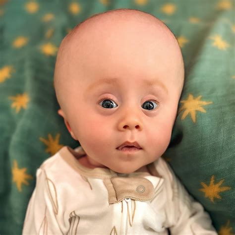 Crawford Osthus impact on the industry leads to service improvements 17