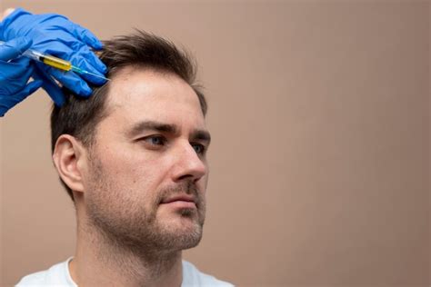 Unlocking Hair Restoration with PRP Therapy | Dermaconsult